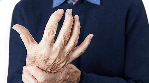 Nahaufnahme von arthritischen Händen.