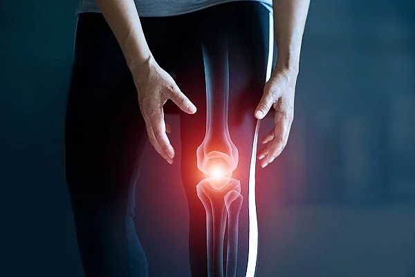 Woman suffering from pain in knee, Injury from workout and osteoarthritis, Tendon problems and Joint inflammation on dark background. Frau mit Knieschmerz/Gelenkentzündung