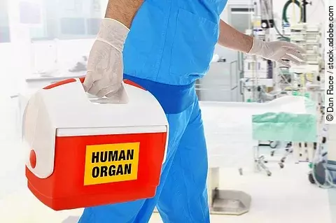 Arzt bringt Organspende in OP für Organtransplantation.