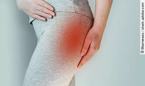 Eine Frau, die am Piriformis Syndrom leidet, fasst sich an den Oberschenkel.
