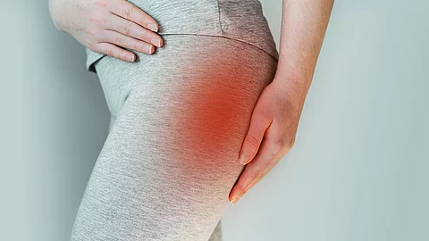 Eine Frau, die am Piriformis Syndrom leidet, fasst sich an den Oberschenkel.
