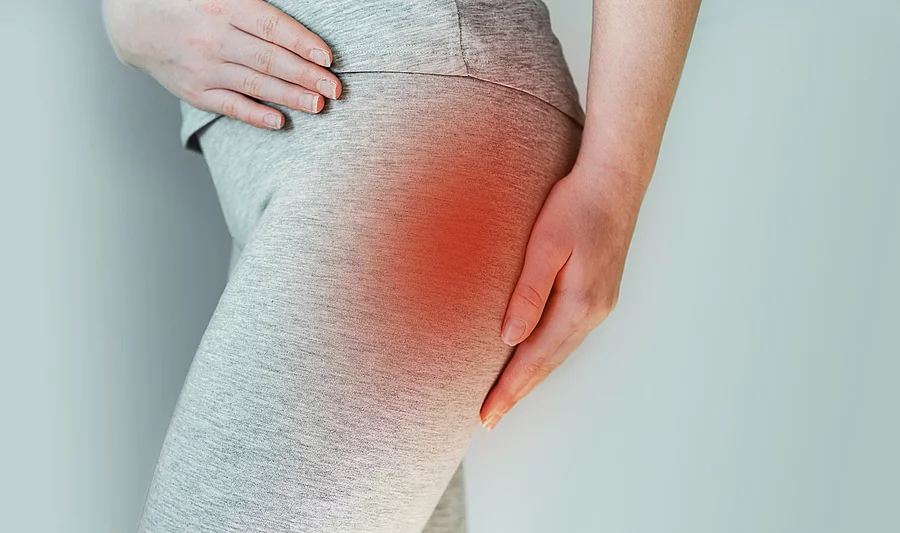 Eine Frau, die am Piriformis Syndrom leidet, fasst sich an den Oberschenkel.