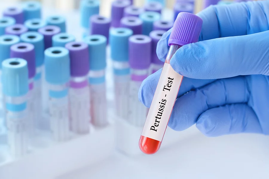 Hand mit blauen Gummihandschuhen hält eine Pertussi-Blutprobe im Labor