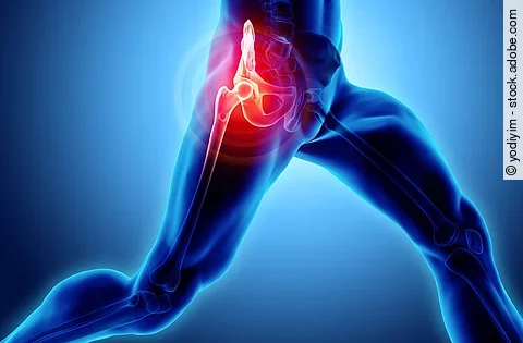 3D illustration eines schmerzenden Hüftgelenks in Bewegung