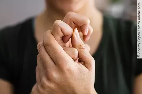 Frau mit rheumatisch gekrümmten Fingergelenken hält sich die Hände