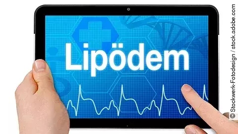 Tablet mit Diagnose Lipödem