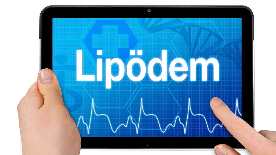 Tablet mit Diagnose Lipödem