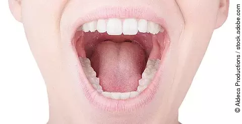 Frau mit geöffnetem Mund