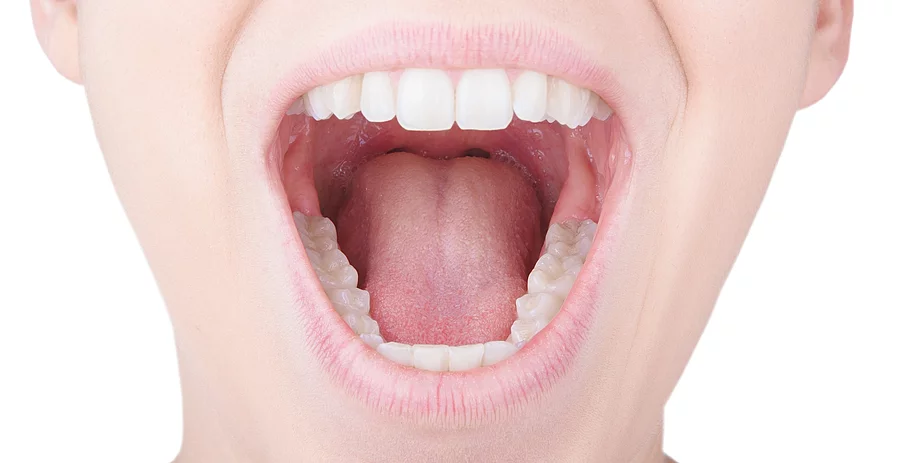 Frau mit geöffnetem Mund