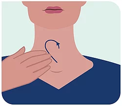 Illustration einer Schilddrüsenmassage.