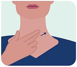Illustration einer Schilddrüsenmassage.