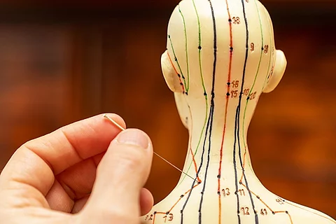 Akupunkturmodell, Meridiane, Akupunkturnadel, Hand
