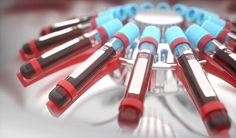 Zentrifuge für Blutröhrchen im Labor.