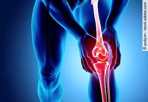 Repro: Knieschmerz, männliche Person hält sich das rot eingefärbte Kniegelenk