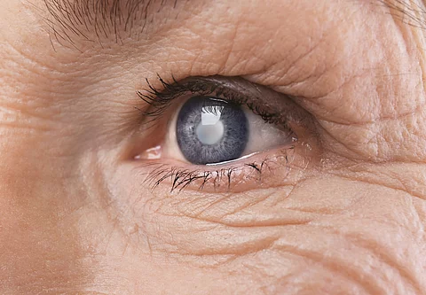 Nahansicht eines Auges bei einer Seniorin