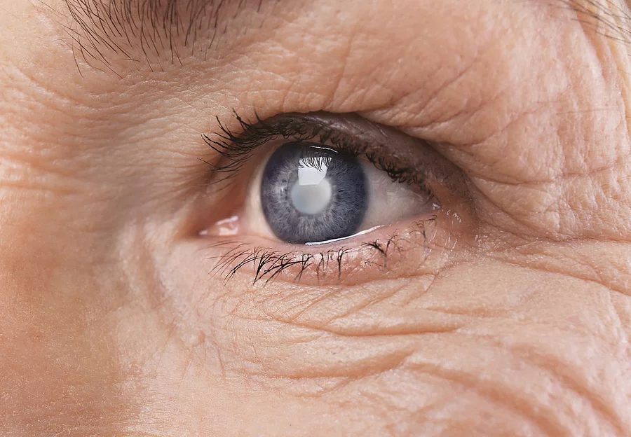Nahansicht eines Auges bei einer Seniorin