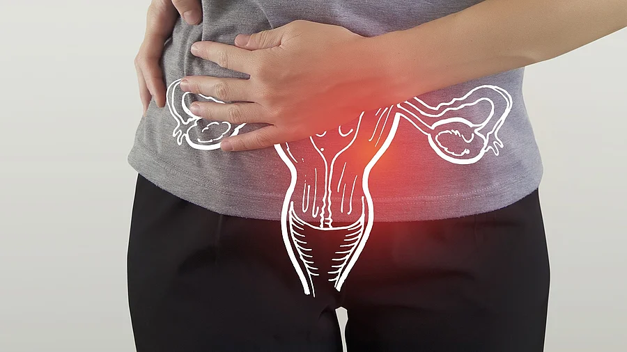 Unterbauch einer Frau, mit aufgezeichneter Gebärmutter und Eierstöcken 