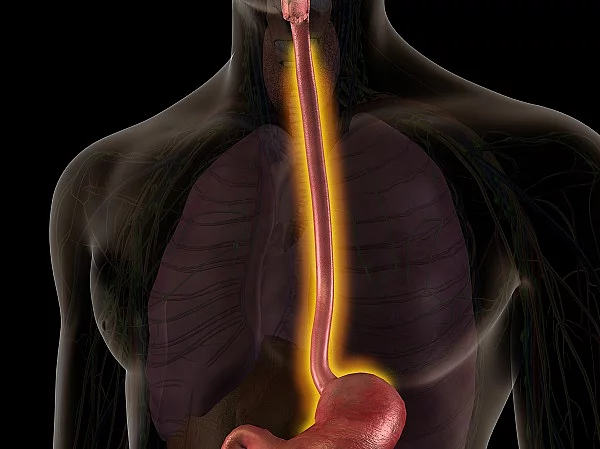 Mann, Anatomie, Speiseröhre, Entzündung 
