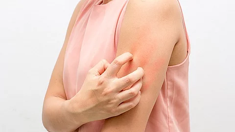 Frau kratzt sich mit der Hand am Oberarm