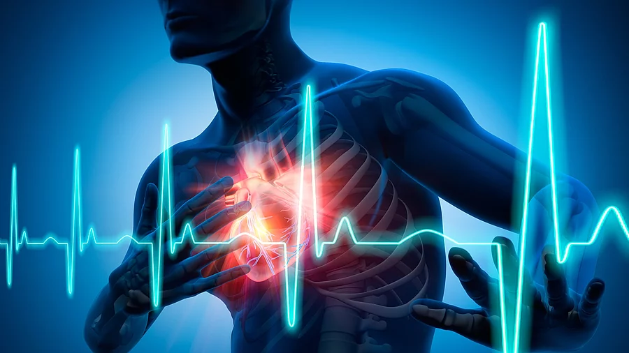 Illustration: Männlicher Körper mit signalrotem Herzen und EKG-Kurve 