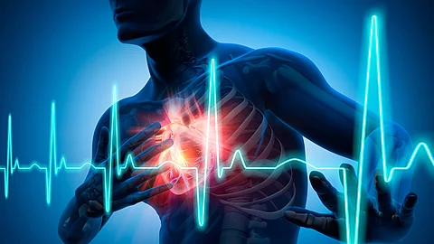 Illustration: Männlicher Körper mit signalrotem Herzen und EKG-Kurve 