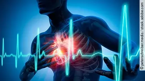 Illustration: Männlicher Körper mit signalrotem Herzen und EKG-Kurve 