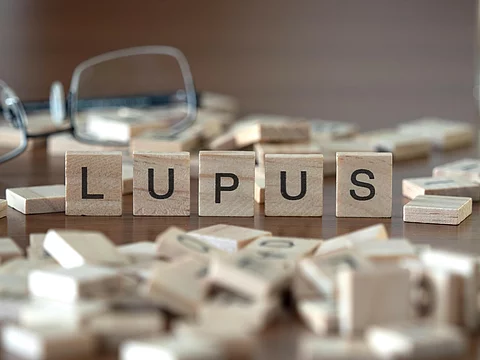 Holzbuchstaben bilden das Wort Lupus. 