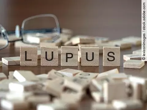 Holzbuchstaben bilden das Wort Lupus. 