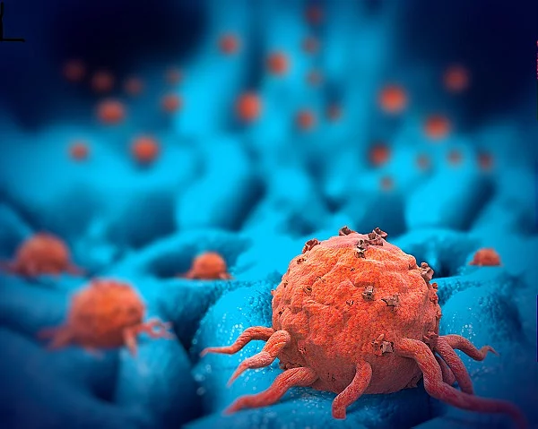 Cancer cells, 3d illustration 3-D-Illustration: Krebszellen