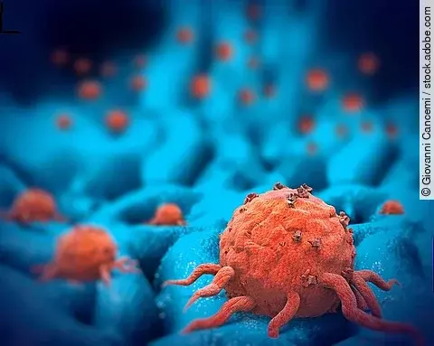 3-D-Illustration: Krebszellen