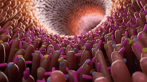 Darm, Darmbarriere, Rheuma, Leaky Gut