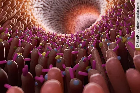 Darm, Darmbarriere, Rheuma, Leaky Gut