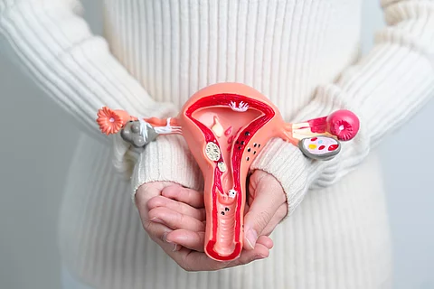 Frau hält ein Modell mit Uterus und Eierstöcken mit Zysten vor ihrem Unterbauch
