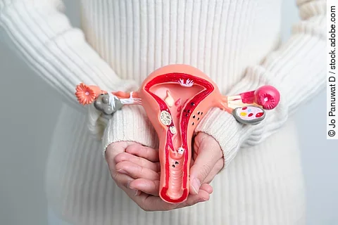 Frau hält ein Modell mit Uterus und Eierstöcken mit Zysten vor ihrem Unterbauch