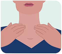 Illustration einer Schilddrüsenmassage.