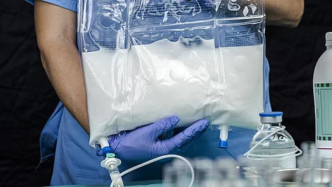 Krankenpfleger hält Infusionsbeutel für parenterale Ernährung in der Hand