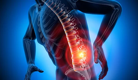 Rücken-Schmerzpunkt Animation