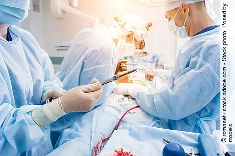 Chirurgischer Eingriff an der Wirbelsäule: 3 Ärzte stehen am OP-Tisch.