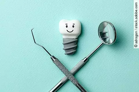 Zahn mit Implantat und Smiley, Zahnarztbesteck auf türkisem Hintergrund