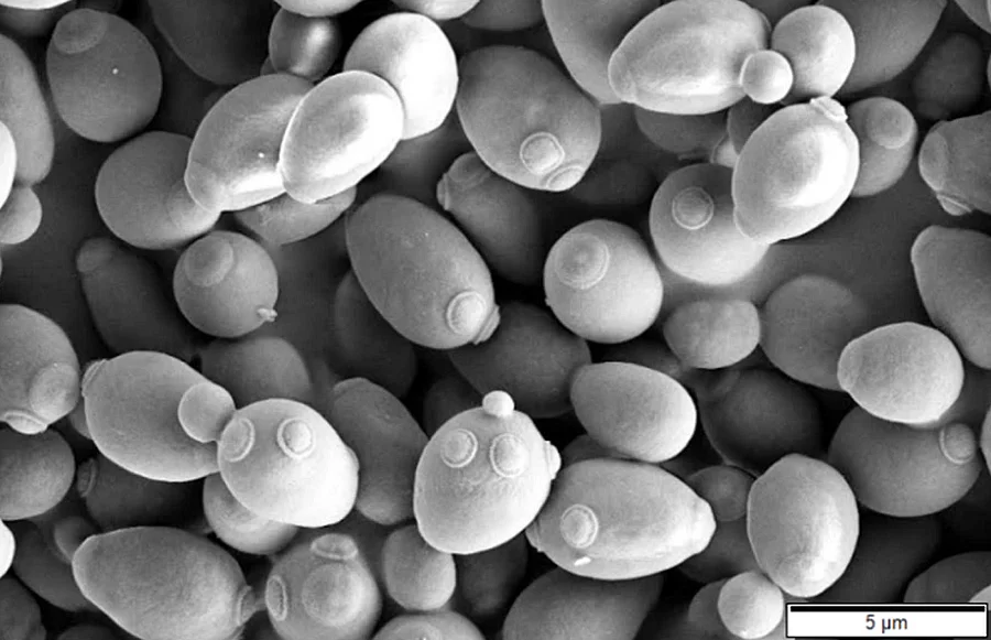 Der Hefepilz Saccharomyces cerevisiae unter dem Mikroskop