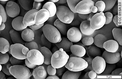 Der Hefepilz Saccharomyces cerevisiae unter dem Mikroskop