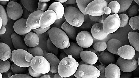 Der Hefepilz Saccharomyces cerevisiae unter dem Mikroskop