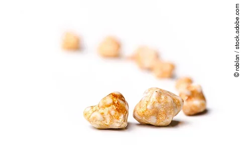 Gallensteine vor weißem Hintergrund.