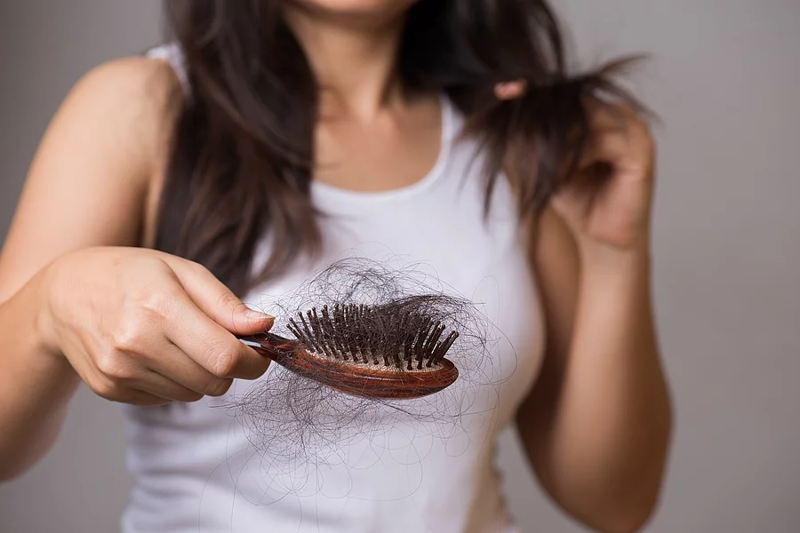 Frau mit Haarausfall und vielen Haaren in der Haarbürste.