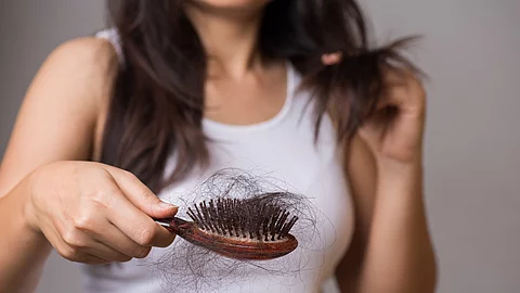 Frau mit Haarausfall und vielen Haaren in der Haarbürste.