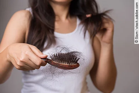 Frau mit Haarausfall und vielen Haaren in der Haarbürste.