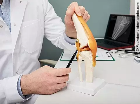 Arzt zeigt am Kniemodell das Kreuzband 