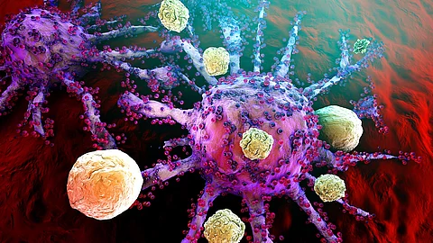 T-Cells of the immune System attacking growing Cancer cells T-Zellen attackieren Tumorzelle