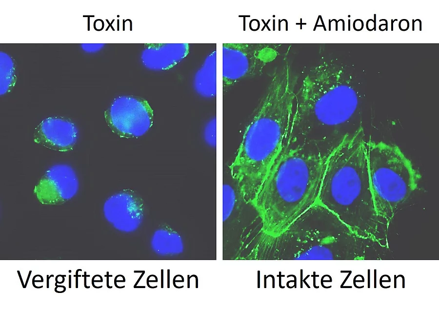Mikroskopische Aufnahme von Clostridium-Toxinen, links mit kollabiertem Zellskelett, rechts mit intaktem Zellskelett bei Amiodaronbehandlung