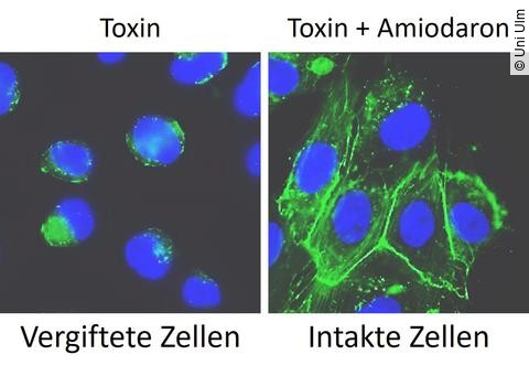 Mikroskopische Aufnahme von Clostridium-Toxinen, links mit kollabiertem Zellskelett, rechts mit intaktem Zellskelett bei Amiodaronbehandlung